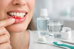 How to Treat Bleeding Gums Safely
